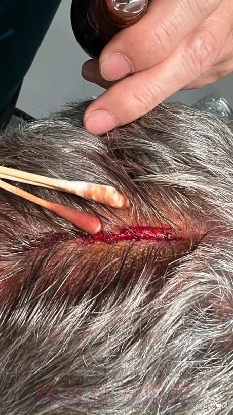 安帅:想以微弱优势晋级 2粒上角的进球不可能扑出